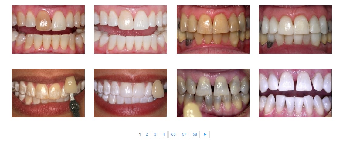 Before & Afters